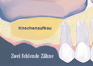 Aufbau Knochen